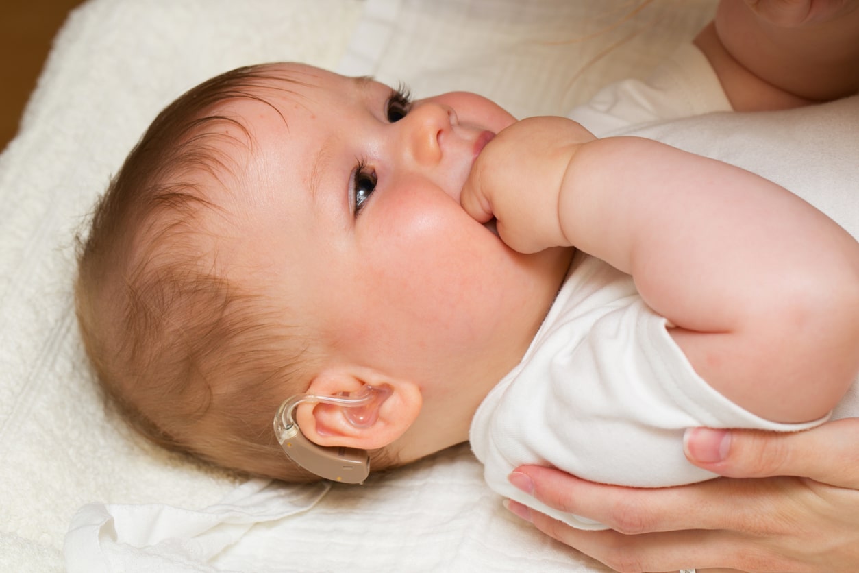 Infant with a hearing aid.